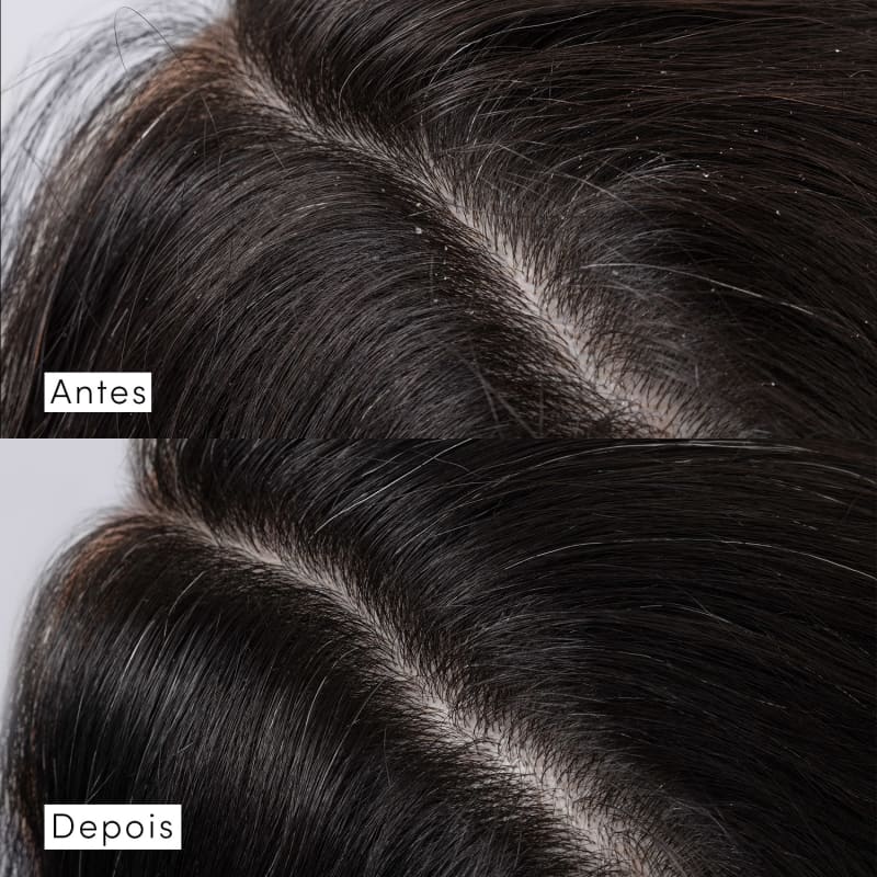 Shampoo Siàge Dermo Hair Scalp Rebalance 300ml - Imagem 3